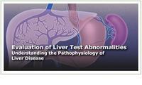Thumbnail image of Evaluating Liver Test Abnormalities: Understanding the Pathophysiology of Liver Disease 