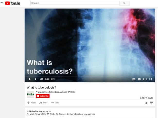  What is TB? Video 