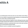 Hep A (Web)