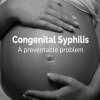 Congenital Syphilis A Preventable Problem (Web)