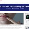 Are Cold Sores Herpes STD? (Web)