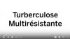 Drug-Resistant Tuberculosis in French (Congo) 