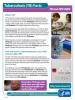 TB and HIV/AIDS Fact Sheet 