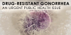 Drug-Resistant Gonorrhea: An Urgent Public Health Issue. Go to Youtube Video.