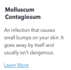 What is Molluscum Contagiosum (Web)