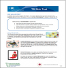 TB Skin Test. Go to fact sheet.