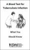 A Blood Test for Tuberculosis Infection: What You Should Know