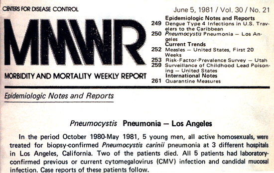 clipping from the issue of MMWR featuring the first report on what would be known as the AIDS epidemic