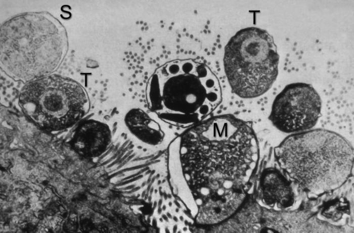 Electron microscope photo of HIV
